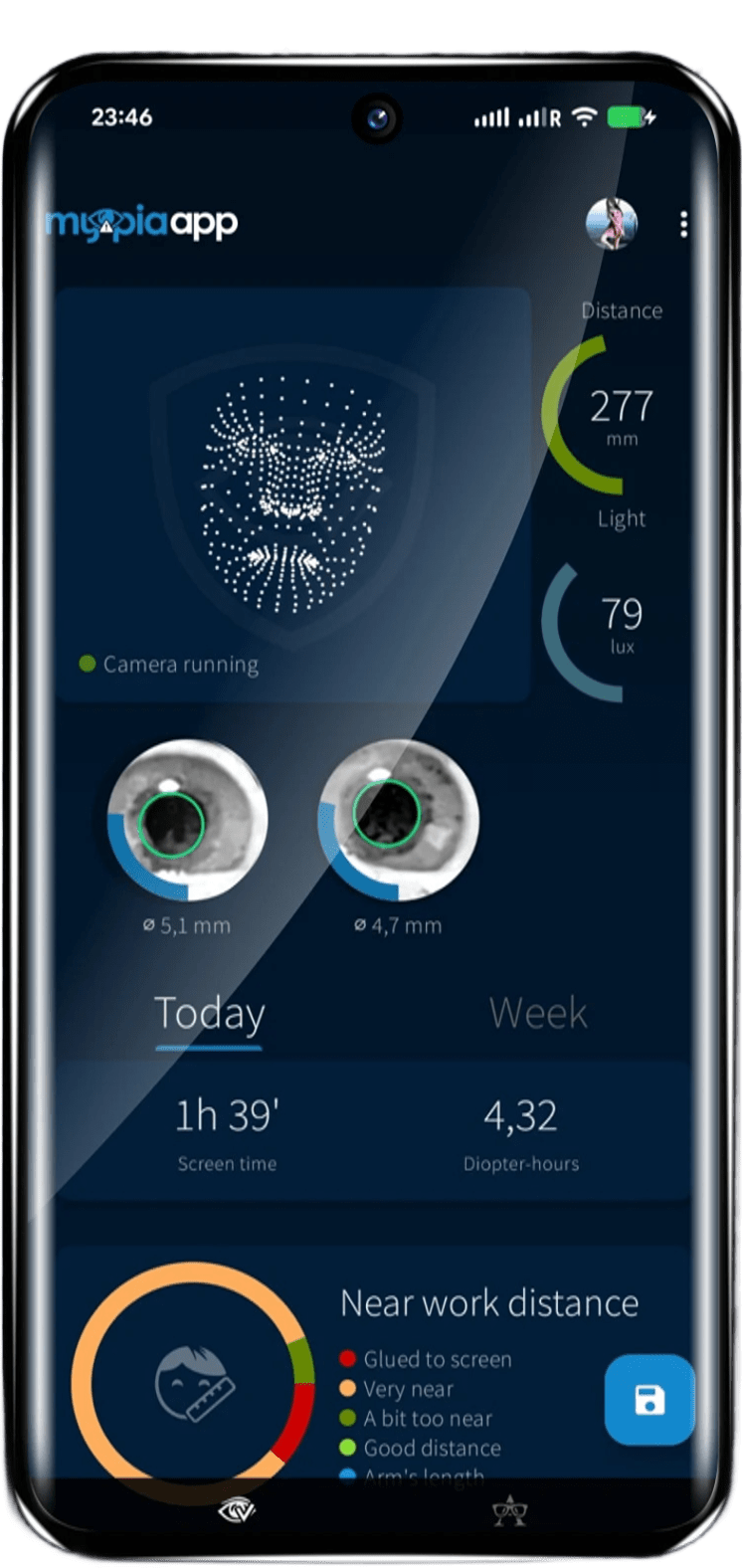 Live monitoring